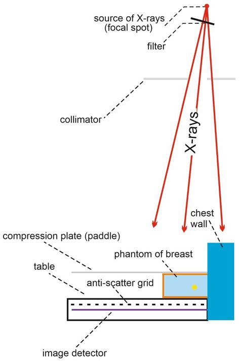 Optimization of Image Quality in Digital Mammography with the Response of a Selenium Detector by ...