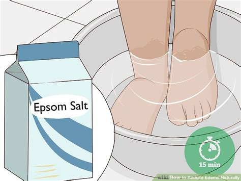 Cure Edema 的图像结果