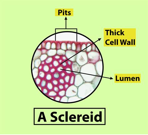Xylem Sclerenchyma