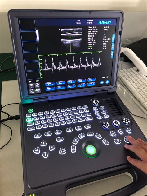 B/W High-End Pw Portable Ultrasound Ultrasonic System - Ultrasound and Black and White