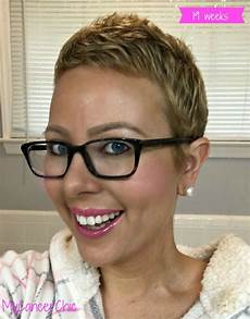 Post Chemo Hairstyles