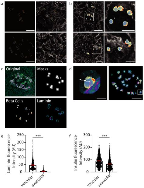 Machine Learning Algorithms, Applied to Intact Islets of Langerhans ...