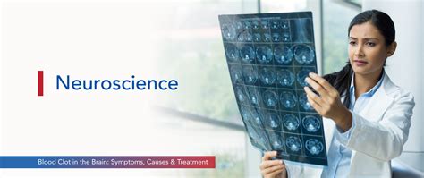 Blood Clot in Brain:Symptoms, Causes & Treatment | SPARSH Hospital