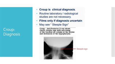 PPT - ‘Tis the Season: Croup, bronchiolitis, and influenza PowerPoint Presentation - ID:201516
