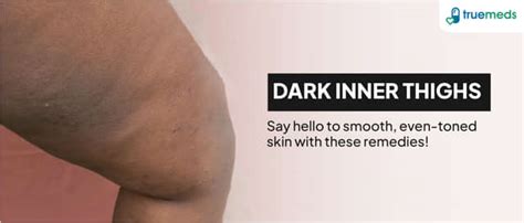 Mucolite Tablet: Uses, Side Effects, Price & Substitutes