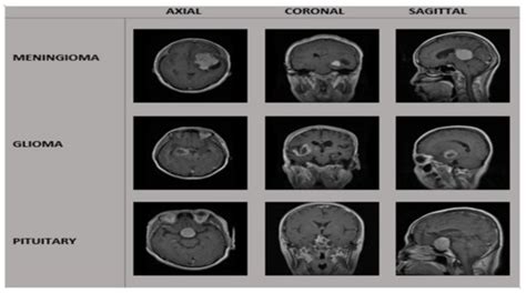 A Hybrid Deep Learning-Based Approach for Brain Tumor Classification