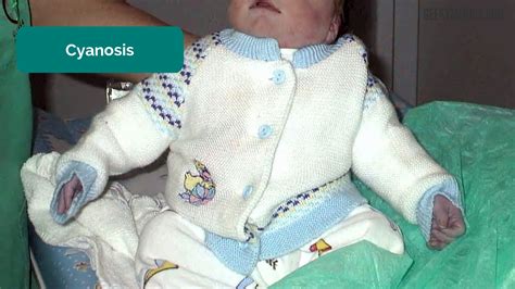 Newborn Baby Assessment (NIPE) - OSCE Guide | Geeky Medics