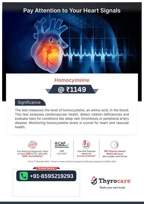 HOMOCYSTEINE Test @ 1149 | Thyrocare