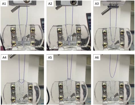 Zigzag Barbed Polydioxanone Thread Implantation and Evaluation Using ...