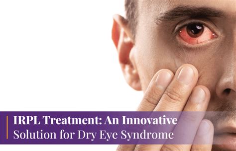IRPL Treatment: An Innovative Solution for Dry Eye Syndrome - Welcome ...