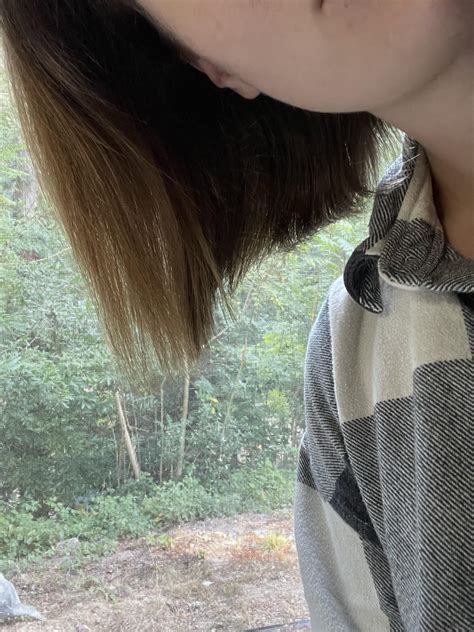 11 months ago, 5 months ago, and TODAY on 1.25 oral minoxidil : r ...