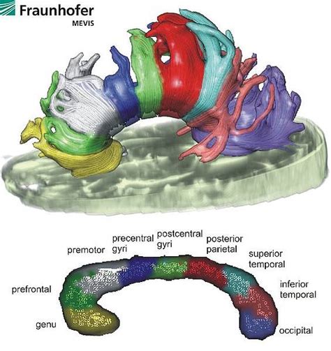 Image result for MeVisLab Features