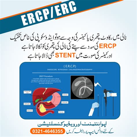 ERCP/ERC | drmasifgul