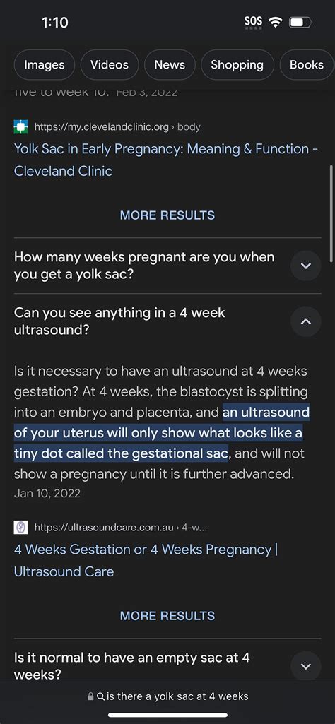 4 weeks ultrasound | BabyCenter