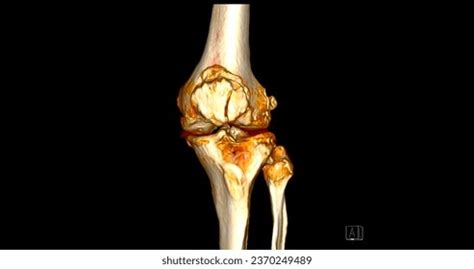 Image result for Alien Brett Death