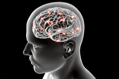 Multiple System Atrophy 的图像结果