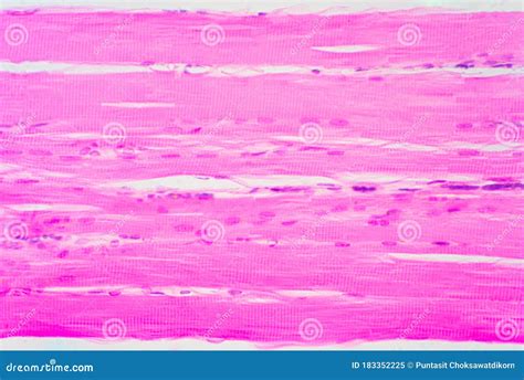 Image result for Skeletal Muscle Tissue Under Microscope