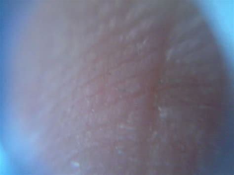 Image result for Finger Under Microscope