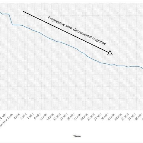 Image result for Muscle Stress Graph