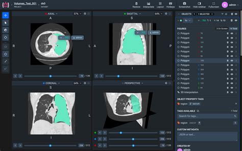 DICOM Query Retrieve Tool 的图像结果
