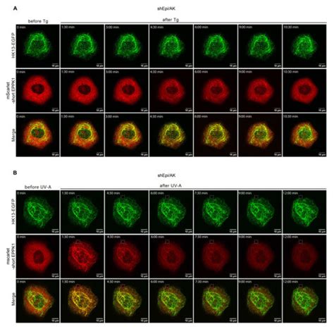 Cells | Special Issue : Frontiers in Cytoskeleton Research—from ...