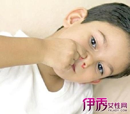 【儿童经常流鼻血是什么原因】【图】分析儿童经常流鼻血是什么原因 6个方法帮你快速止鼻血(3)_伊秀亲子|yxlady.com