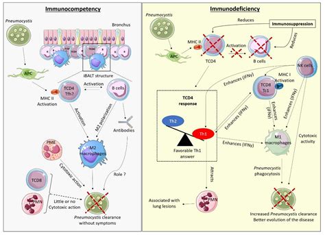 Immune Response in Pneumocystis Infections According to the Host Immune ...