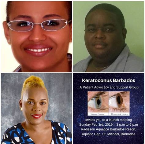 Keratoconus Barbados – A support and advocacy group for the rare eye condition launches ...