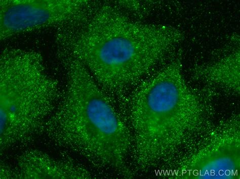 ARHGEF1 antibody (11363-1-AP) | Proteintech