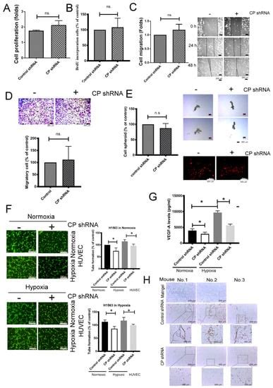 Loss of miR-145-5p Causes Ceruloplasmin Interference with PHD-Iron Axis ...