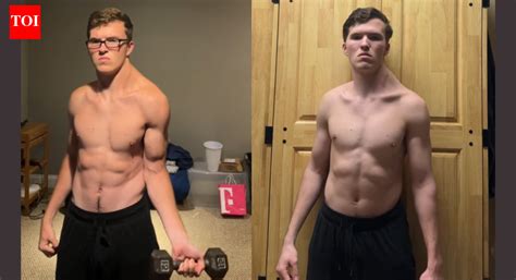 Extreme asymmetry: Doctors warn after influencer spends 300 days ...