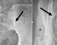 ACTA Medica International — Global Peer-Reviewed Medical Journal