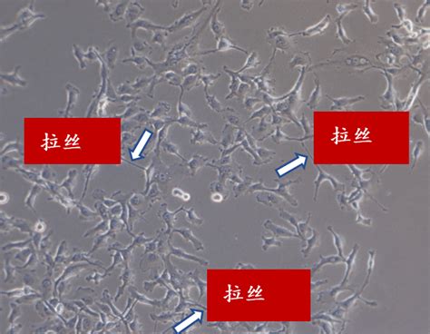 你的细胞是被什么污染了？怎么处理？这里有图有介绍！_细菌_制霉菌素_真菌