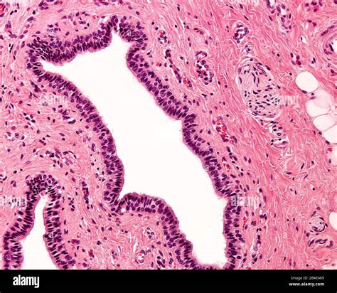 Stratified Columnar Epithelial Tissue