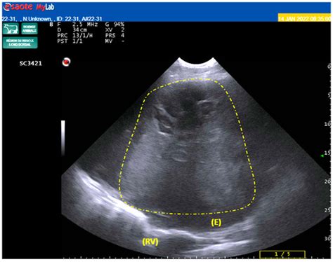Thoracic Tumor Associated with a Unilateral Empyema in a Beef Cow: A ...