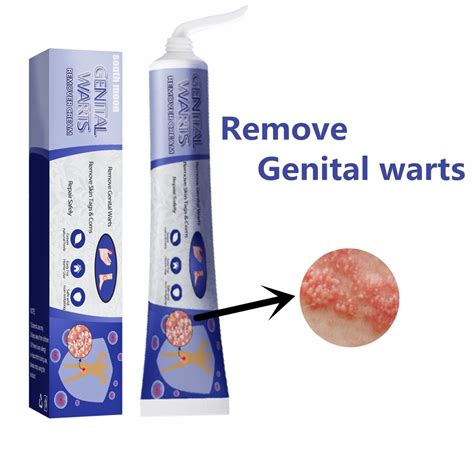 Skin Tag Remover genital warts removal cream tick tag removal Warts removal cream Remove warts ...