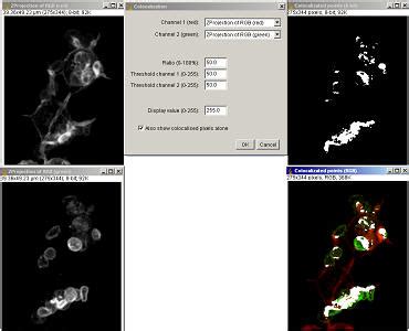 ImageJ Colocalization Analysis 的图像结果