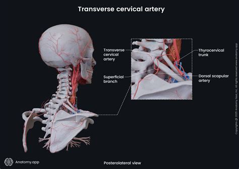 Transverse Cervical Artery Cervical Arterial Dissections And