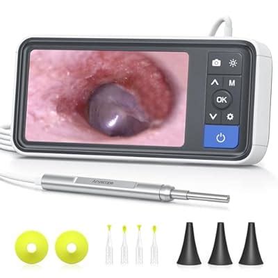 Anykit Digital Otoscope with Gyroscope, 4.5 Inches India | Ubuy