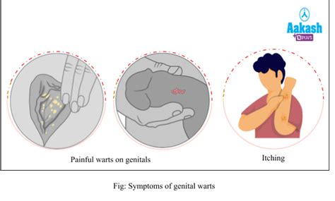 Sexually Transmitted Diseases: Complications & General Precautions | AESL