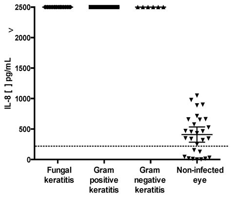 Expression of IL-8, IL-6 and IL-1β in Tears as a Main Characteristic of ...
