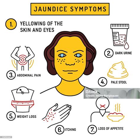 Jaundice Symptoms Infographic In Outline Style Vector Illustration Isolated On A White ...