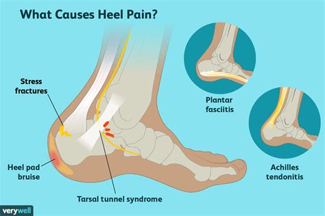 Causes of Heel Pain in Seniors - Almawi Limited The Holistic Clinic
