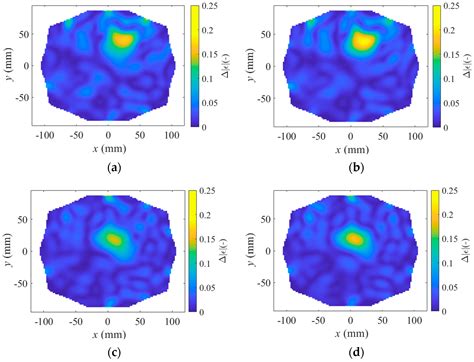 An Experimental 10-Port Microwave System for Brain Stroke Diagnosis ...