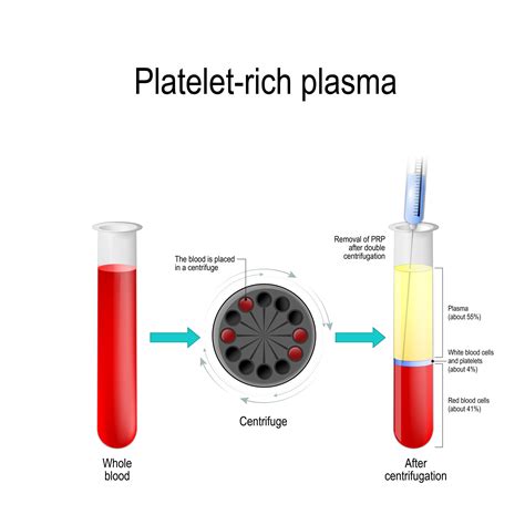 What Is A Platelet Injection at Erik Nowak blog