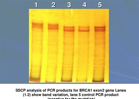 Image result for Conformational Polymorphism