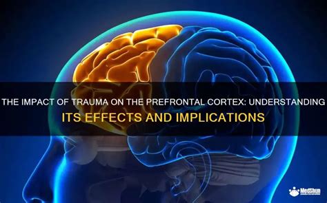 Image result for Prefrontal Cortex Damage