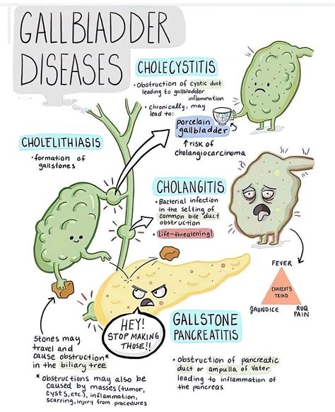 Gallbladder Diseases Chart - Phartoonz