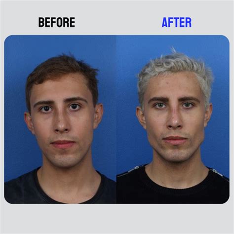 JawFlex Pro - Jaw Trainer – Himalayan Cloud