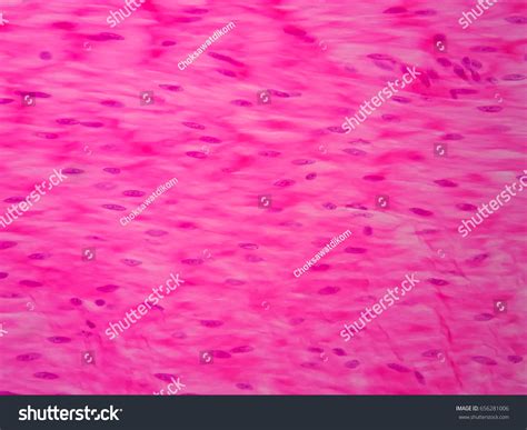 Histology Human Smooth Muscle Under Microscope: ภาพสต็อก (แก้ไขตอนนี้ ...